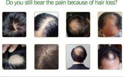 Haarserum 7days | Haarkuur 7daags | Haaruitval Bestrijden | Gember Extracten Voor Stimuleren Haargroei | Haar Olie | Bewezen Formule -Verzorgingsproducten 1200x747 2