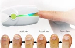 Anti Schimmelnagel Kalknagel Laserapparaat Om Zelf Te Behandelen, Veilig, Effectief, Snel En Pijnloos, Koude Laser Behandeling Voor Thuisgebruik, Voor Tenen En Vingers. Oplaadbaar. 10 Anti Schimmelnagel Kalknagel Laserapparaat Om Zelf Te Behandelen, Veilig, Effectief, Snel En Pijnloos, Koude Laser Behandeling Voor Thuisgebruik, Voor Tenen En Vingers. Oplaadbaar. -Verzorgingsproducten 1200x774