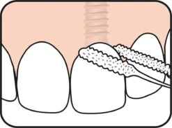 Tepe Floss Bridge & Implant 30 St -Verzorgingsproducten 1200x899 8