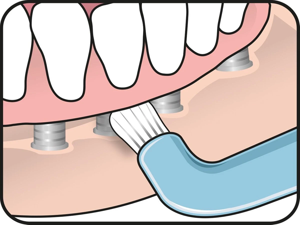 TePe Compact Tuft - Single Tufted Borstel - Tandenborstel 10 TePe Compact Tuft - Single Tufted Borstel - Tandenborstel - Afbeelding 10