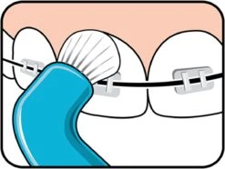 TePe Compact Tuft - Single Tufted Borstel - Tandenborstel 21 TePe Compact Tuft - Single Tufted Borstel - Tandenborstel -Verzorgingsproducten 1200x902 1