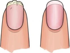 Herome 3 In 1 Manicure Nagelverzorging Set Blauw – Nagelset Voor Beschadigde Nagels - Nagelverharder, Nagellakremover En Nagelriemcreme - Set Van 3 -Verzorgingsproducten 1200x920