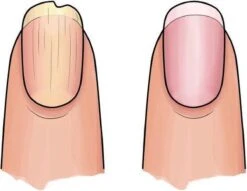 Herome 3 In 1 Manicure Nagelverzorging Set (Nail Essentials Geel) – Nagelset Voor Droge En Geribbelde Nagels – Base Coat, Vijl En Voedende Nagelolie – Voor Egale En Flexibele Nagels 11 Herome 3 In 1 Manicure Nagelverzorging Set (Nail Essentials Geel) – Nagelset Voor Droge En Geribbelde Nagels – Base Coat, Vijl En Voedende Nagelolie – Voor Egale En Flexibele Nagels -Verzorgingsproducten 1200x926