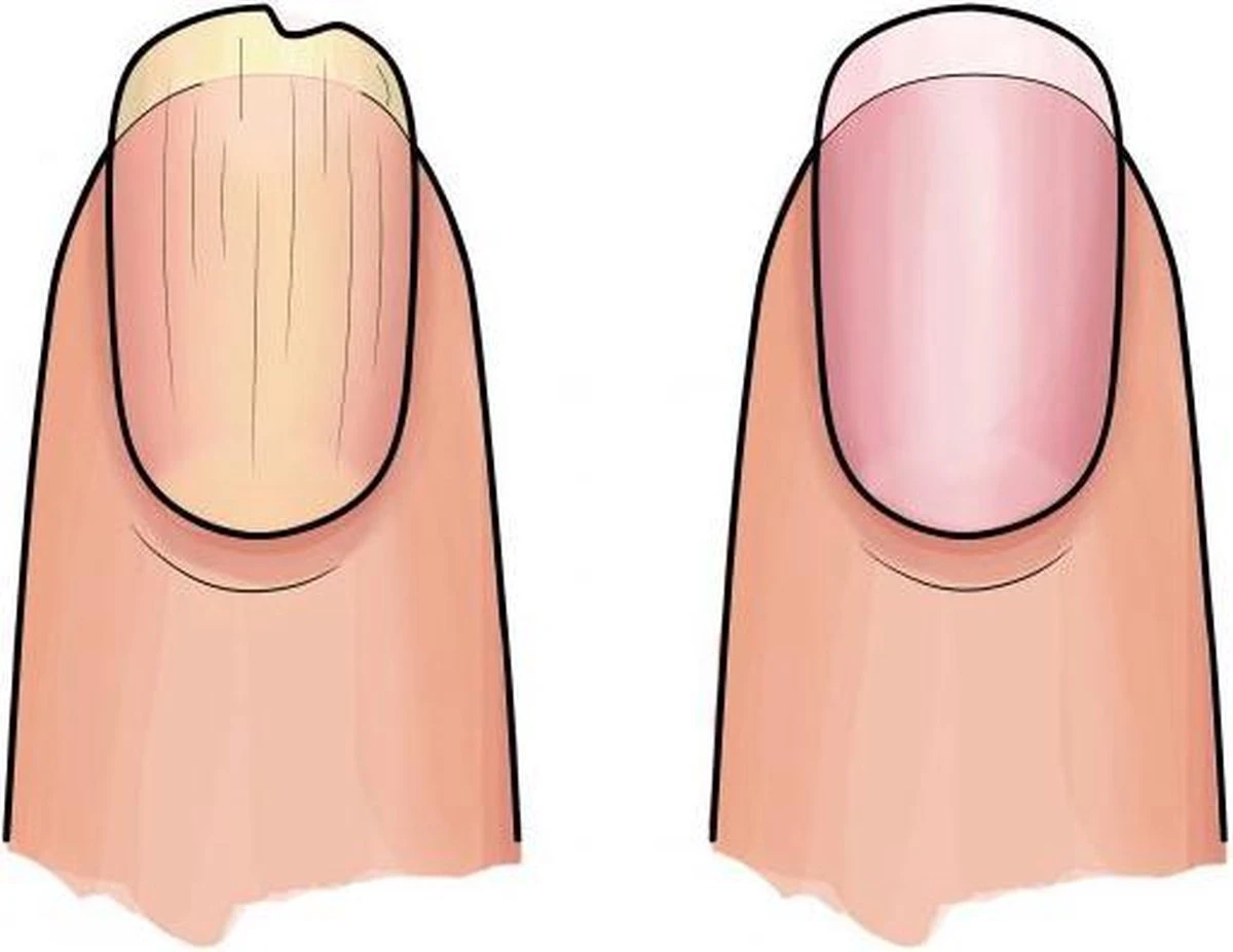 Herome 3 In 1 Manicure Nagelverzorging Set (Nail Essentials Geel) – Nagelset Voor Droge En Geribbelde Nagels – Base Coat, Vijl En Voedende Nagelolie – Voor Egale En Flexibele Nagels 3 Herome 3 In 1 Manicure Nagelverzorging Set (Nail Essentials Geel) – Nagelset Voor Droge En Geribbelde Nagels – Base Coat, Vijl En Voedende Nagelolie – Voor Egale En Flexibele Nagels - Afbeelding 3