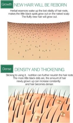 Haarserum 7days | Haarkuur 7daags | Haaruitval Bestrijden | Gember Extracten Voor Stimuleren Haargroei | Haar Olie | Bewezen Formule -Verzorgingsproducten 716x1200 2